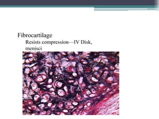 Fibrocartilage
Resists compression—IV Disk,
menisci
 