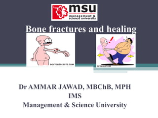Bone fractures and healing
Dr AMMAR JAWAD, MBChB, MPH
IMS
Management & Science University
 