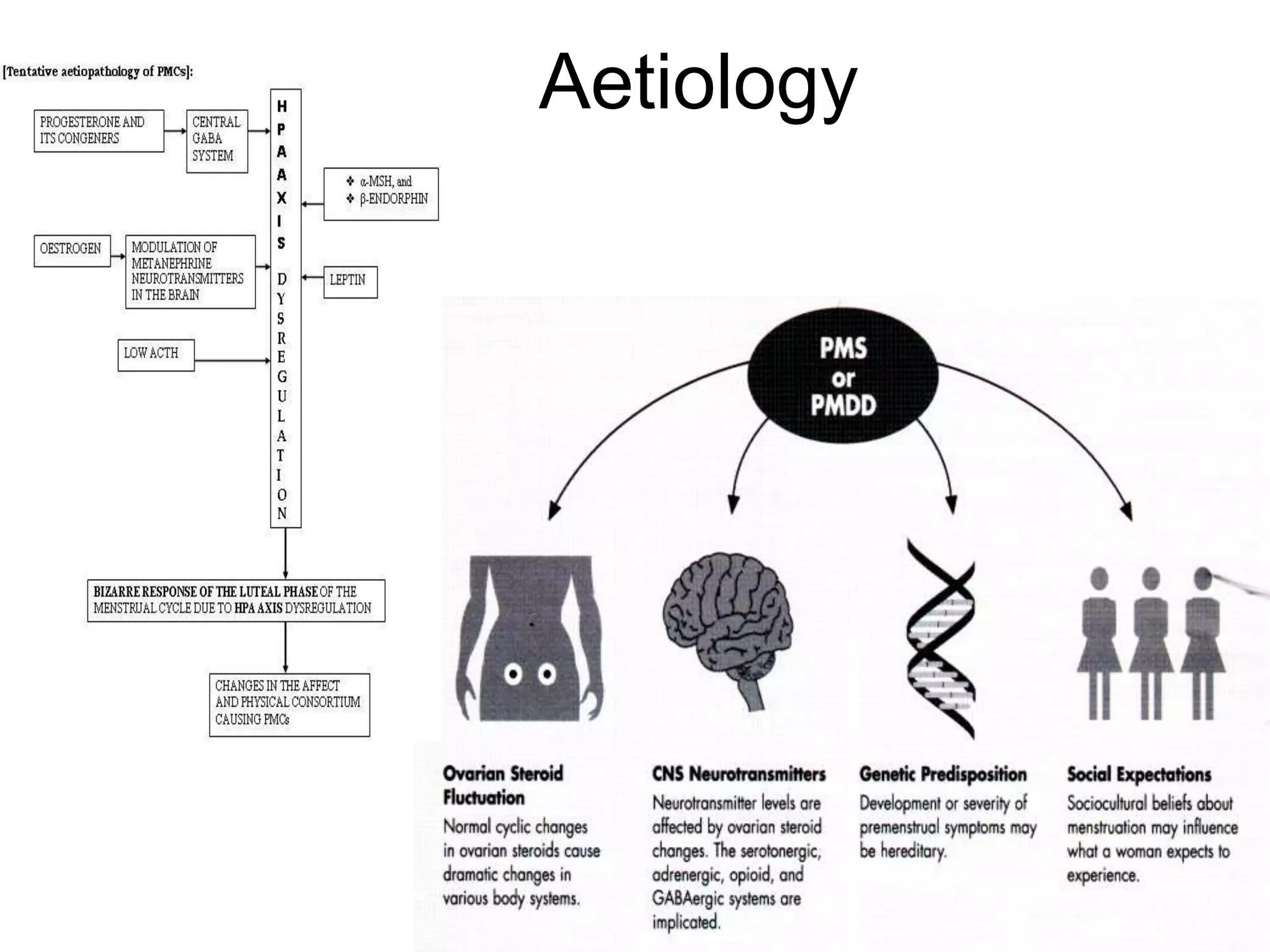 Aetiology
 