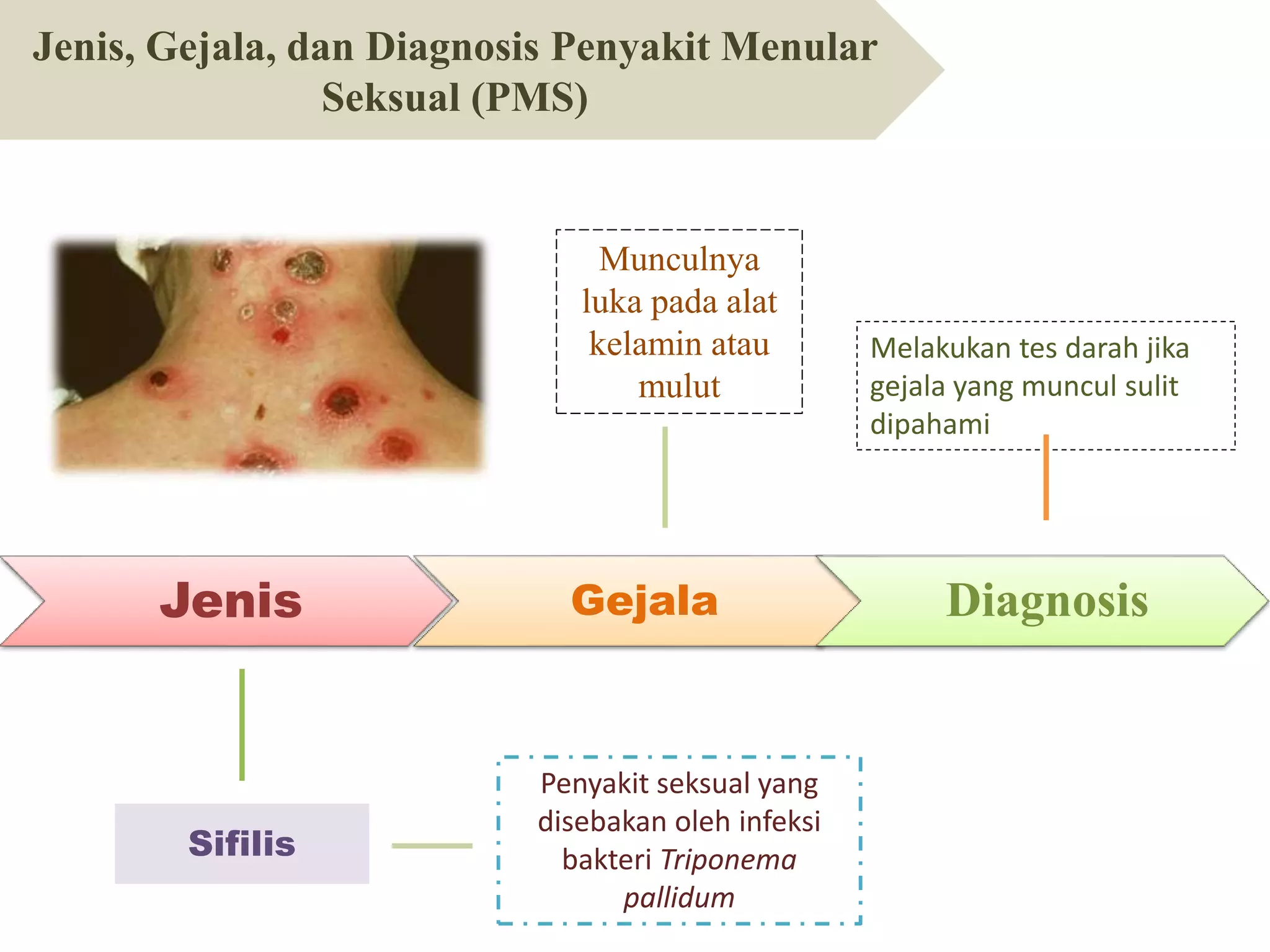 PPT Penyakit Menular Seksual | PPTX