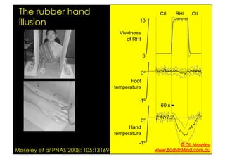 Rubber Hand Illusion - an overview