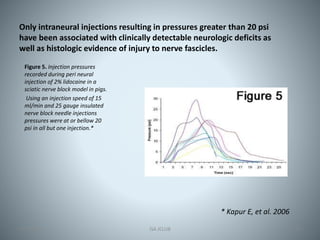 Neuract Injection Neurologic Complications of Peripheral Nerve Blocks | PPTX