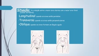 Situação: é a relação entre o maior eixo uterino com o maior eixo fetal
(coluna vertebral).
*Longitudinal: quando os eixos estão paralelos.
*Transversa: quando os eixos estão perpendiculares.
*Oblíqua: quando os eixos formam um ângulo agudo
 