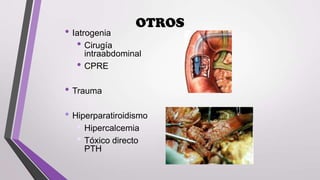 • Iatrogenia
• Cirugía

•

OTROS

intraabdominal
CPRE

• Trauma

• Hiperparatiroidismo
• Hipercalcemia
• Tóxico directo
PTH

 