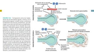 Pancreatitis Crónica (Patogenia) 
 