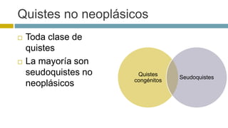 Quistes no neoplásicos 
 Toda clase de 
quistes 
 La mayoría son 
seudoquistes no 
neoplásicos 
Quistes 
congénitos 
Seudoquistes 
 