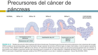 Precursores del cáncer de 
páncreas 
 