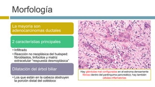 Morfología 
La mayoría son 
adenocarcinomas ductales 
2 característias principales 
• Infiltrado 
• Reacción no neoplásica del huésped: 
fibroblastos, linfocitos y matriz 
extracelular “respuesta desmoplásica” 
Dilatación del árbol biliar 
• Los que están en la cabeza obstruyen 
la porción distal del colédoco 
Hay glándulas mal configuradas en el estroma densamente 
fibroso dentro del parénquima pancreático; hay también 
células inflamatorias 
 