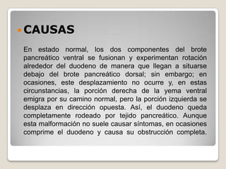  CAUSAS

En estado normal, los dos componentes del brote
pancreático ventral se fusionan y experimentan rotación
alrededor del duodeno de manera que llegan a situarse
debajo del brote pancreático dorsal; sin embargo; en
ocasiones, este desplazamiento no ocurre y, en estas
circunstancias, la porción derecha de la yema ventral
emigra por su camino normal, pero la porción izquierda se
desplaza en dirección opuesta. Así, el duodeno queda
completamente rodeado por tejido pancreático. Aunque
esta malformación no suele causar síntomas, en ocasiones
comprime el duodeno y causa su obstrucción completa.
 