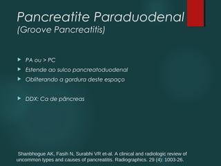 Pancreatite Paraduodenal
(Groove Pancreatitis)
 PA ou > PC
 Estende ao sulco pancreatoduodenal
 Obliterando a gordura deste espaço
 DDX: Ca de pâncreas
 Shanbhogue AK, Fasih N, Surabhi VR et-al. A clinical and radiologic review of 
uncommon types and causes of pancreatitis. Radiographics. 29 (4): 1003-26.
 