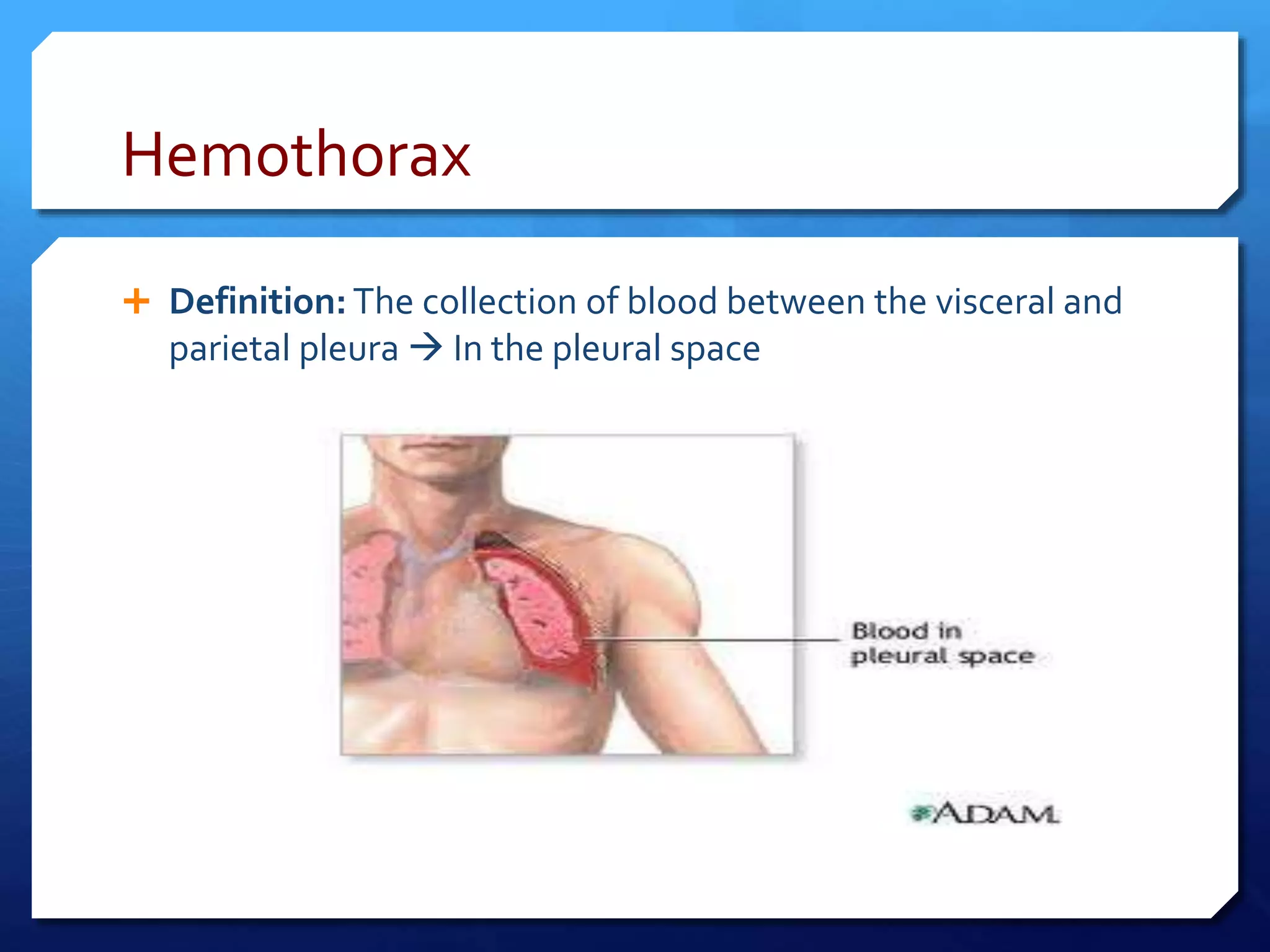 Hemothorax
 Definition: The collection of blood between the visceral and
parietal pleura  In the pleural space
 