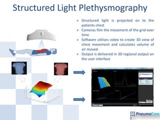 Structured Light Plethysmography
               » Structured light is projected on to the
                 patients chest
               » Cameras film the movement of the grid over
                 time
               » Software utilises video to create 3D view of
                 chest movement and calculates volume of
                 air moved
               » Output is delivered in 3D regional output on
                 the user interface
 