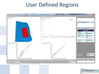 User Defined Regions
 
