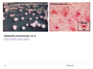 Klebsiella pneumoniae on a
MacConkey agar plate.




                             2-Nov-12
 