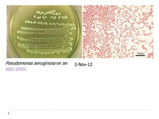 Pseudomonas aeruginosa on an   2-Nov-12
agar plate.
 