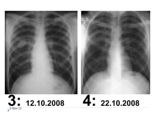 3: 12.10.2008
2-Nov-12
                4: 22.10.2008
 