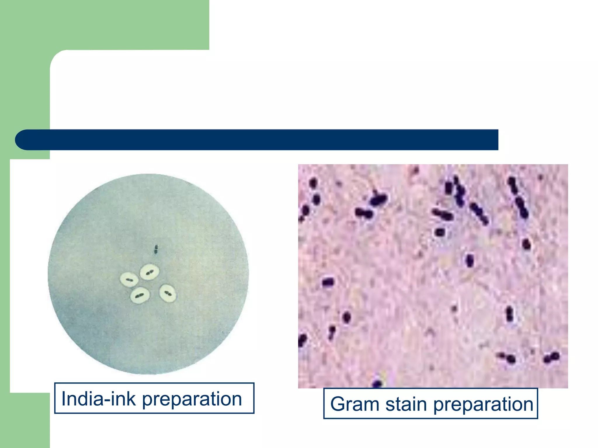 India-ink preparation Gram stain preparation
 