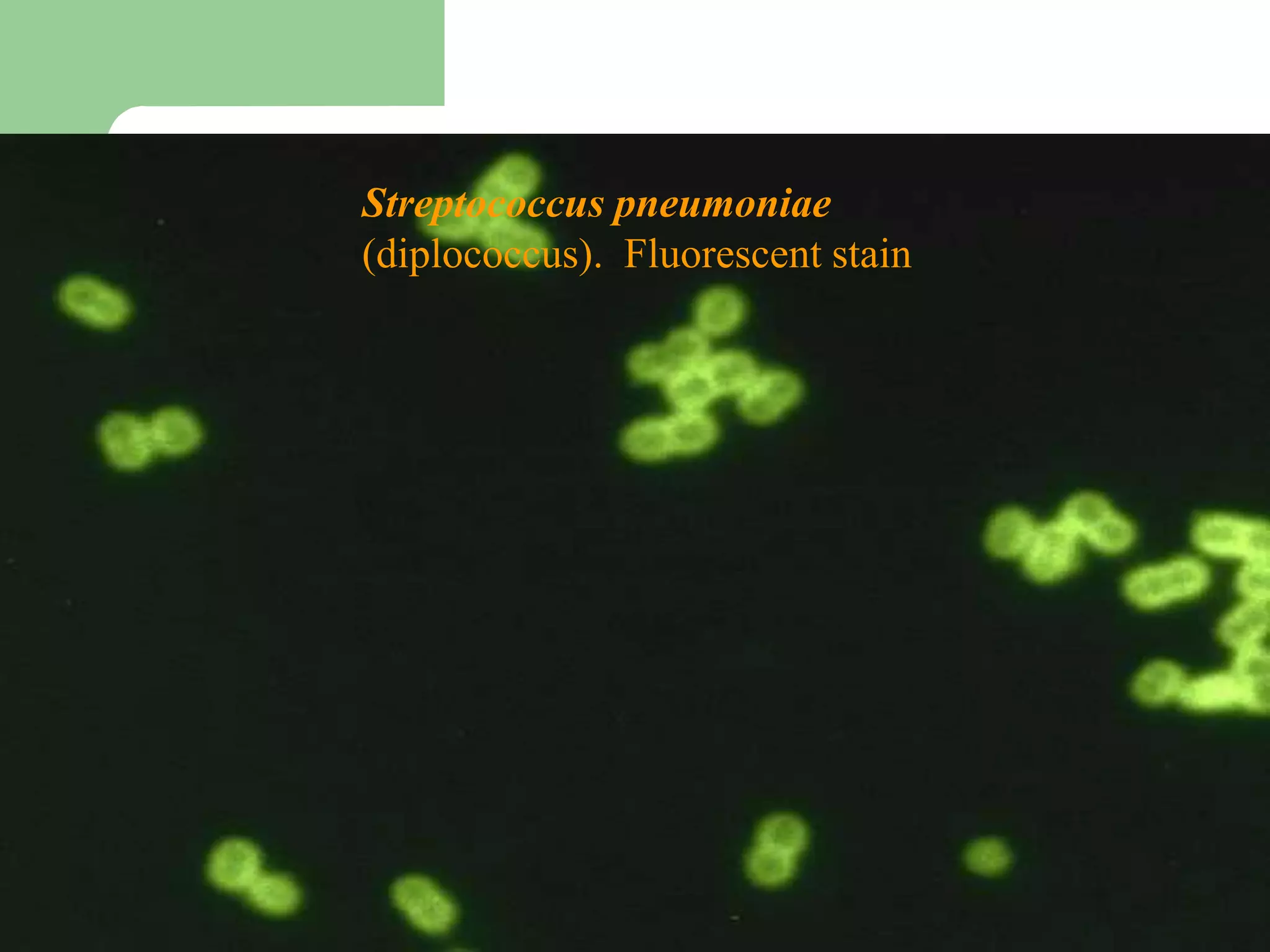 Streptococcus pneumoniae
(diplococcus). Fluorescent stain
 
