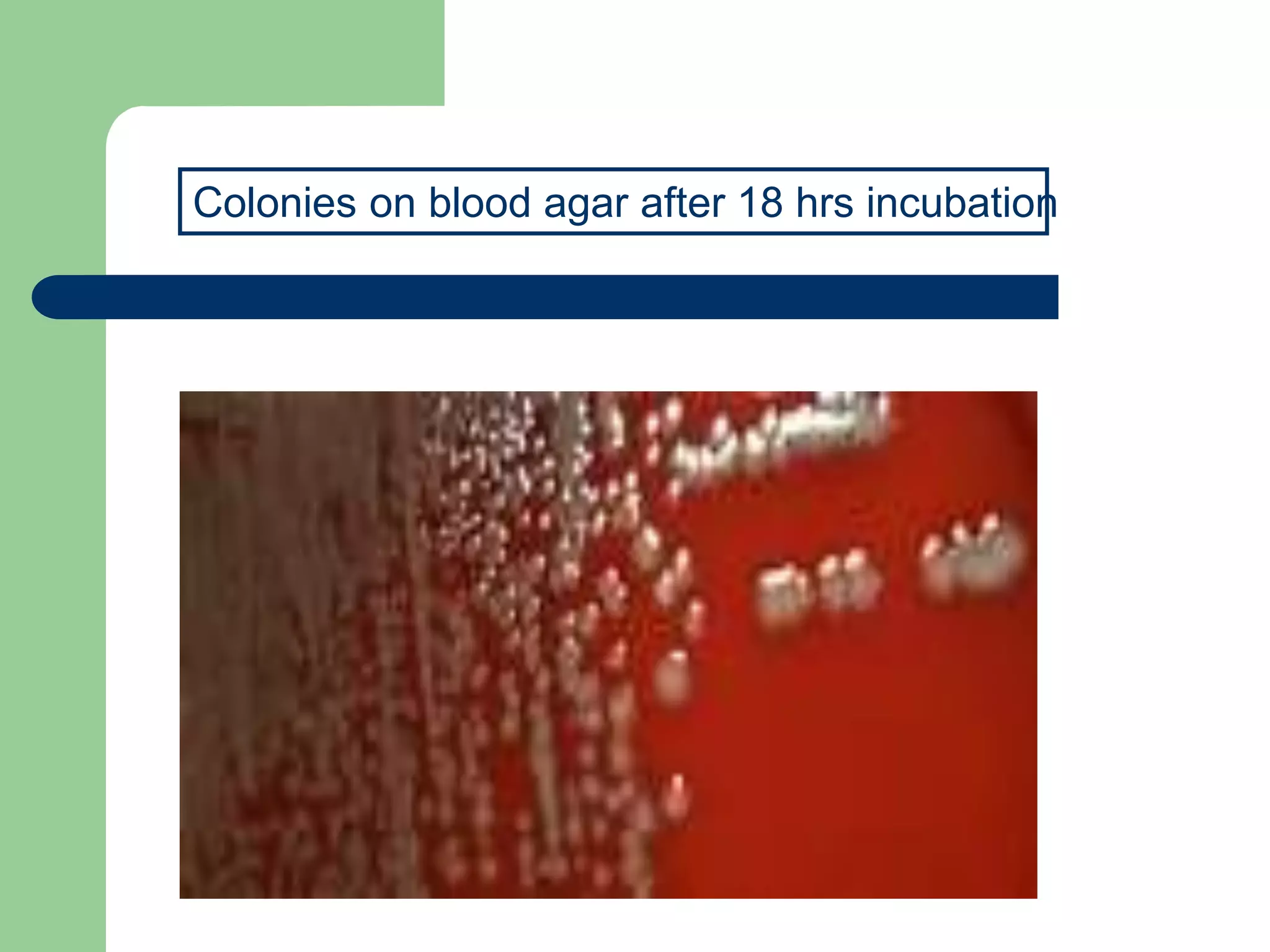 Colonies on blood agar after 18 hrs incubation
 