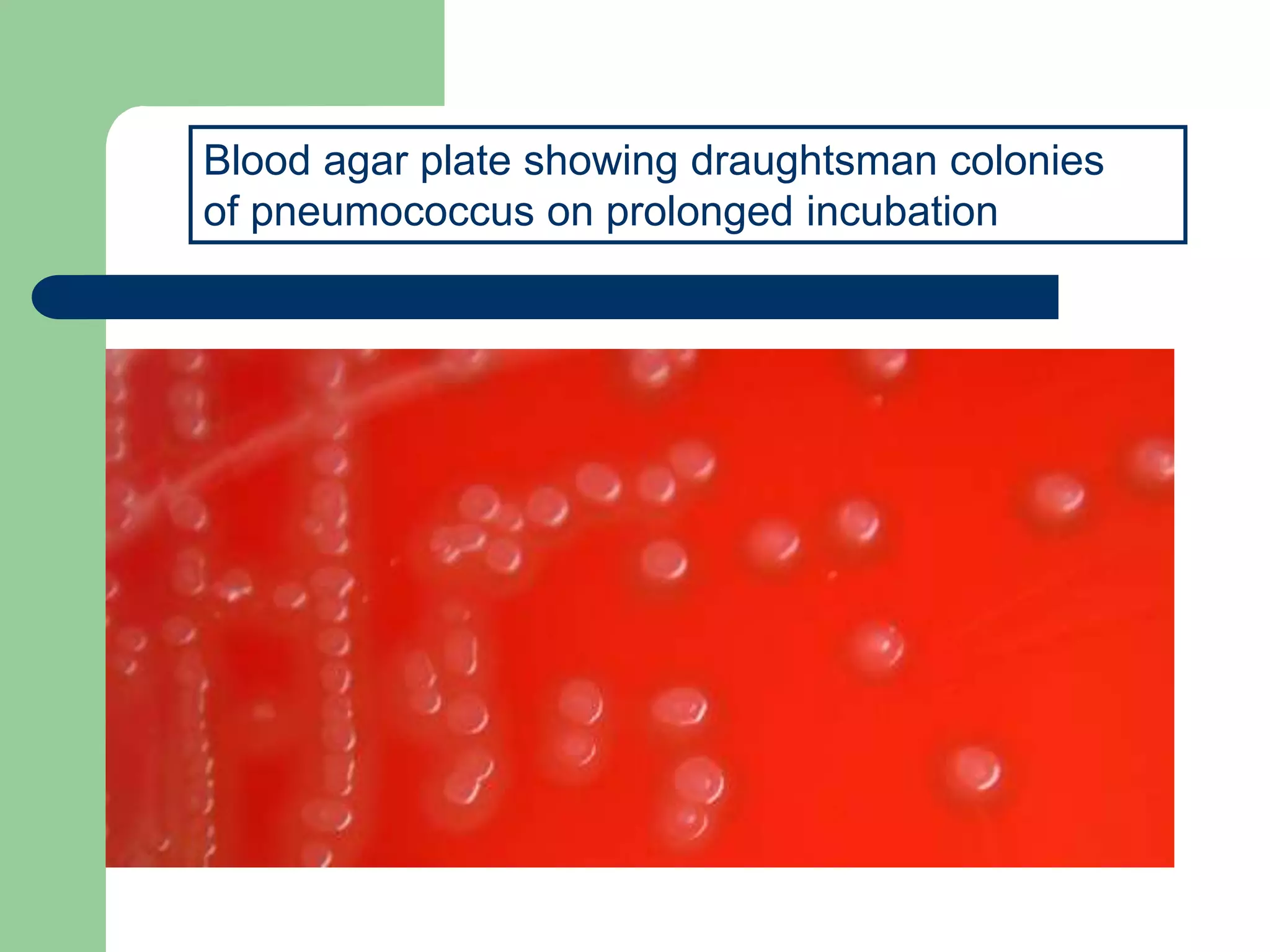Blood agar plate showing draughtsman colonies
of pneumococcus on prolonged incubation
 