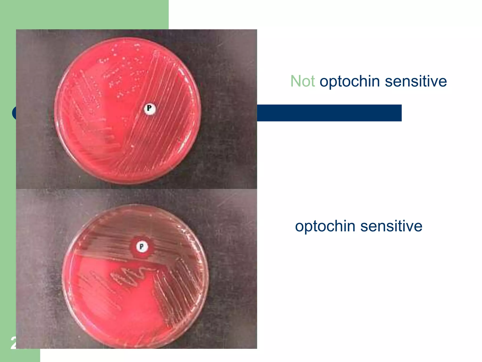 21
Not optochin sensitive
optochin sensitive
 