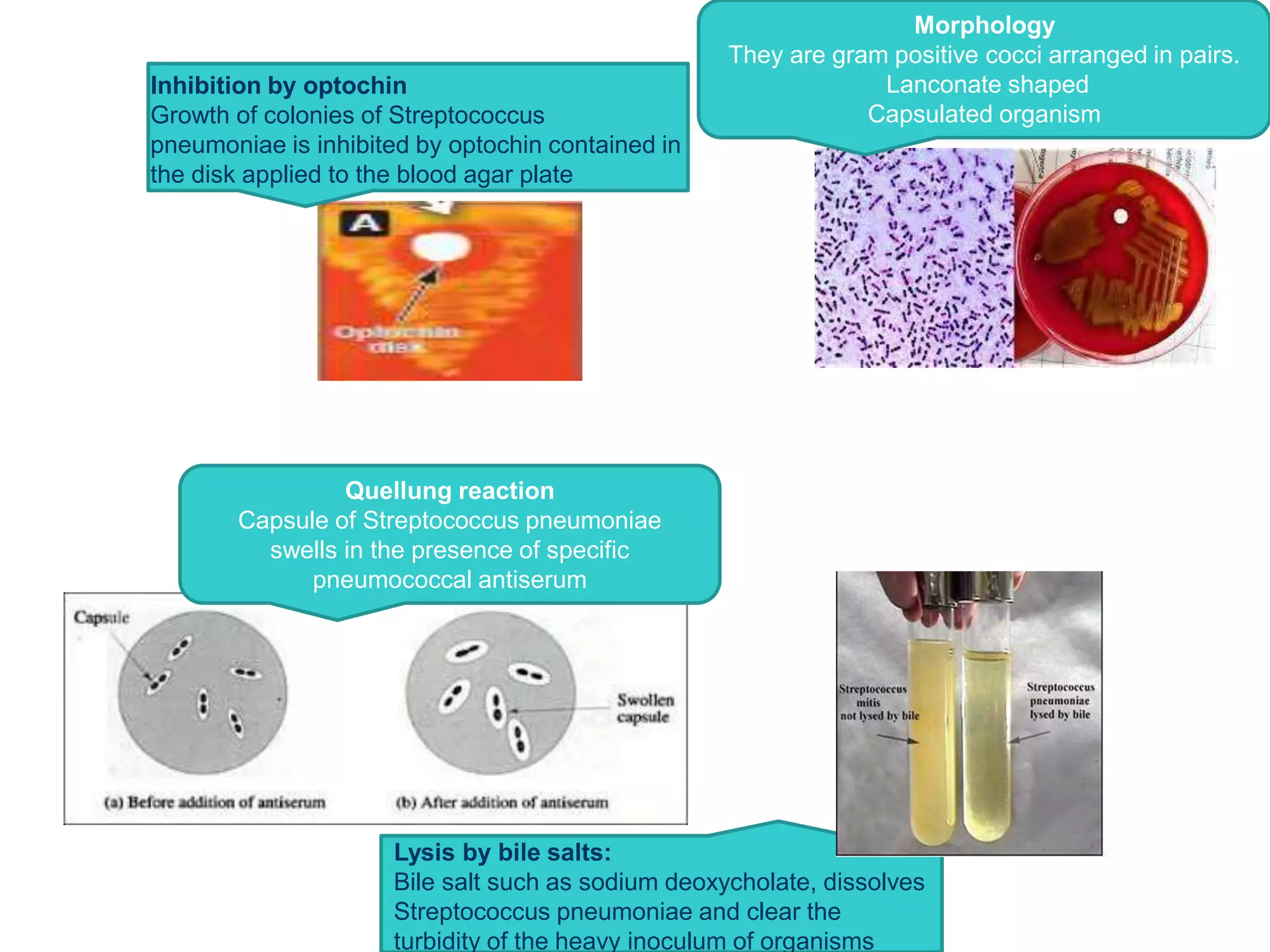 Inhibition by optochin
Growth of colonies of Streptococcus
pneumoniae is inhibited by optochin contained in
the disk applied to the blood agar plate
Lysis by bile salts:
Bile salt such as sodium deoxycholate, dissolves
Streptococcus pneumoniae and clear the
turbidity of the heavy inoculum of organisms
Quellung reaction
Capsule of Streptococcus pneumoniae
swells in the presence of specific
pneumococcal antiserum
Morphology
They are gram positive cocci arranged in pairs.
Lanconate shaped
Capsulated organism
 