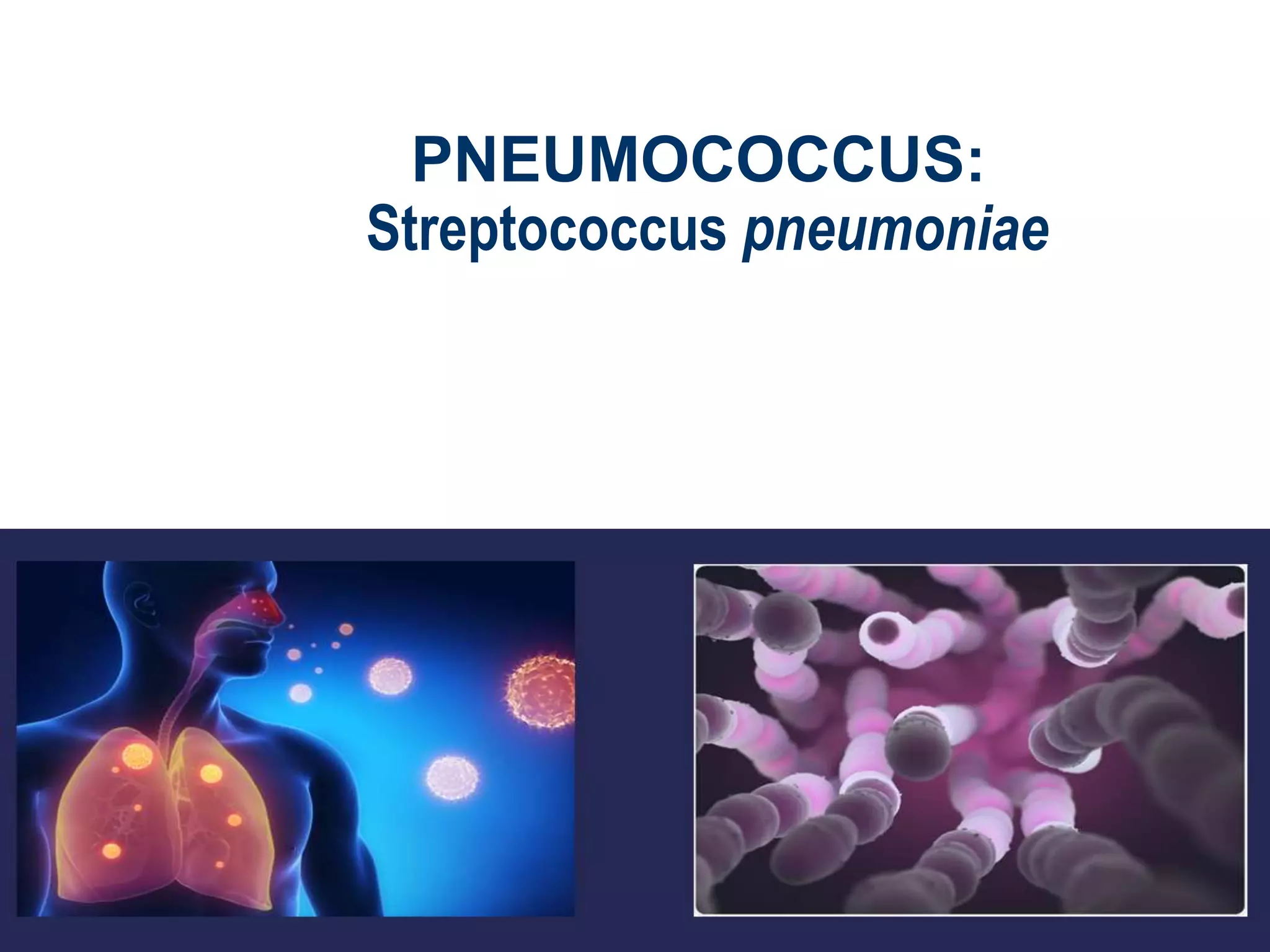 PNEUMOCOCCUS:
Streptococcus pneumoniae
 