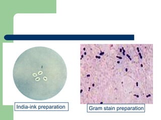 India-ink preparation Gram stain preparation
 