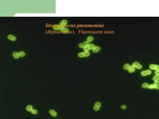 Streptococcus pneumoniae
(diplococcus). Fluorescent stain
 