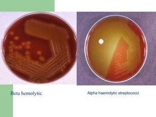 Beta hemolytic Alpha haemolytic streptococci
 