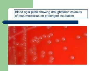 Blood agar plate showing draughtsman colonies
of pneumococcus on prolonged incubation
 