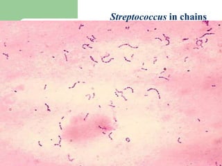 Streptococcus in chains
 