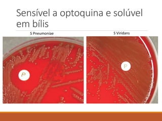 Sensível a optoquina e solúvel
em bílis
S Pneumoniae S Viridans
 