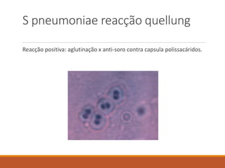 S pneumoniae reacção quellung
Reacção positiva: aglutinação x anti-soro contra capsula polissacáridos.
 