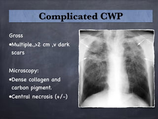 Gross
•Multiple.,>2 cm ,v dark
scars

Microscopy:
•Dense collagen and
carbon pigment.
•Central necrosis (+/-)
Complicated CWP
 