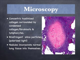 • Concentric hyalinized
collagen surrounded by
condensed
collagen,fibroblasts &
lymphocytes.
• Birefringent silica particles
(polarized light)
• Nodules incorporate normal
lung tissue into themselves.
Microscopy
 