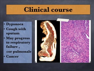 Clinical course
• Dypsnoea
• Cough with
sputum
• May progress
to respiratory
failure ,
cor pulmonale
• Cancer
 