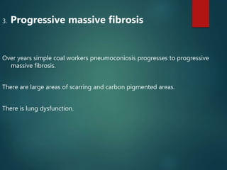 3. Progressive massive fibrosis
Over years simple coal workers pneumoconiosis progresses to progressive
massive fibrosis.
There are large areas of scarring and carbon pigmented areas.
There is lung dysfunction.
 