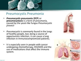 Pneumocystis Pneumonia
• Pneumocystis pneumonia (PCP) or
pneumocystosis is a form of pneumonia,
caused by the yeast-like fungus Pneumocystis
jirovecii
• Pneumocystis is commonly found in the lungs
of healthy people, but, being a source of
opportunistic infection, it can cause a lung
infection in Immunocompromised patients.
• it is especially seen in people with cancer
undergoing chemotherapy, HIV/AIDS and the
use of medications that affect the immune
system.
 