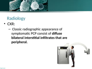 pneumocystispneumonia-140513155717-phpapp01.pptx