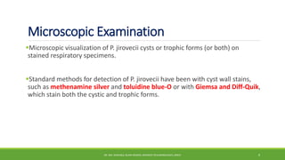 Microscopic Examination
Microscopic visualization of P. jirovecii cysts or trophic forms (or both) on
stained respiratory specimens.
Standard methods for detection of P. jirovecii have been with cyst wall stains,
such as methenamine silver and toluidine blue-O or with Giemsa and Diff-Quik,
which stain both the cystic and trophic forms.
DR. MD. SHAFIQUL ISLAM DEWAN, RESIDENT (PULMONOLOGY), DMCH 9
 