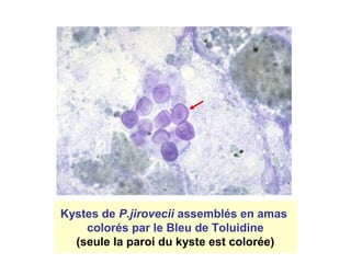 Kystes de P.jirovecii assemblés en amas
    colorés par le Bleu de Toluidine
  (seule la paroi du kyste est colorée)
 