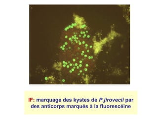 IF: marquage des kystes de P.jirovecii par
 des anticorps marqués à la fluorescéine
 