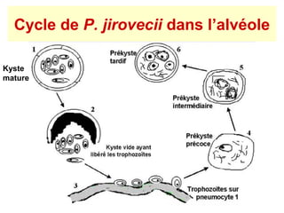 Cycle de P. jirovecii dans l’alvéole

Kyste
mature
 