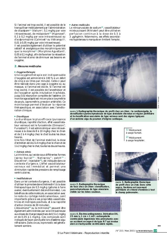 Pneumologie Diagnostic Et Traitement De L Oedeme Aigu Du Poumon