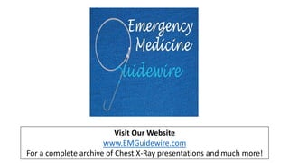 Visit Our Website
www.EMGuidewire.com
For a complete archive of Chest X-Ray presentations and much more!
 