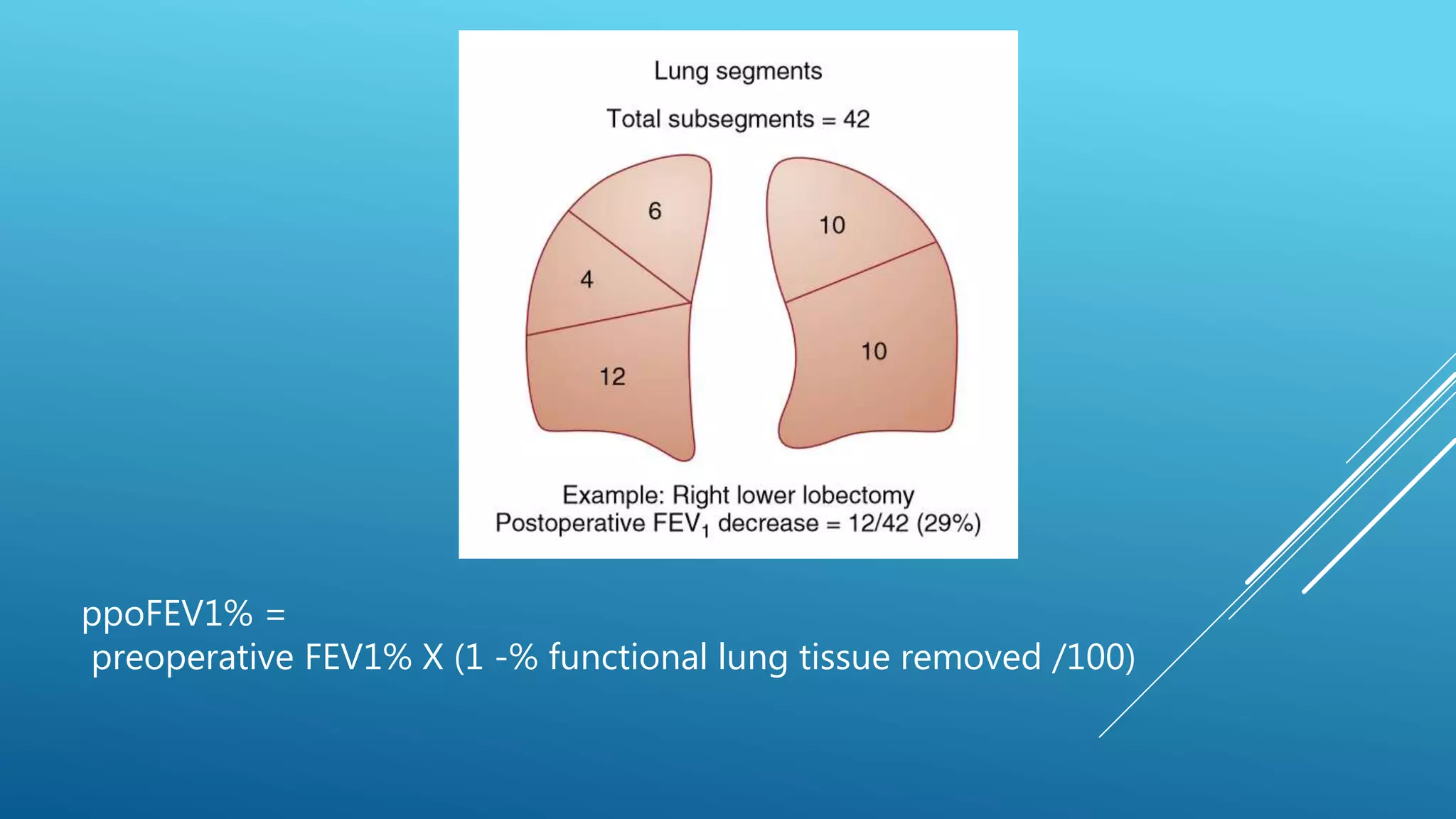 ppoFEV1% =
preoperative FEV1% X (1 -% functional lung tissue removed /100)
 