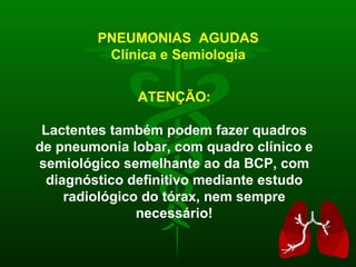 PNEUMONIAS  AGUDAS Clínica e Semiologia ATENÇÃO: Lactentes também podem fazer quadros de pneumonia lobar, com quadro clínico e semiológico semelhante ao da BCP, com diagnóstico definitivo mediante estudo radiológico do tórax, nem sempre necessário! 