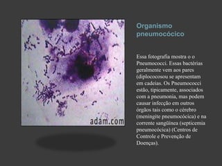 Organismo
pneumocócico
Essa fotografia mostra o o
Pneumococci. Essas bactérias
geralmente vem aos pares
(diplococosou se apresentam
em cadeias. Os Pneumococci
estão, tipicamente, associados
com a pneumonia, mas podem
causar infecção em outros
órgãos tais como o cérebro
(meningite pneumocócica) e na
corrente sangüínea (septicemia
pneumocócica) (Centros de
Controle e Prevenção de
Doenças).
 