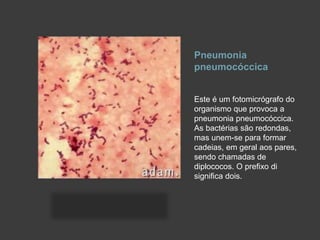 Pneumonia
pneumocóccica
Este é um fotomicrógrafo do
organismo que provoca a
pneumonia pneumocóccica.
As bactérias são redondas,
mas unem-se para formar
cadeias, em geral aos pares,
sendo chamadas de
diplococos. O prefixo di
significa dois.
 